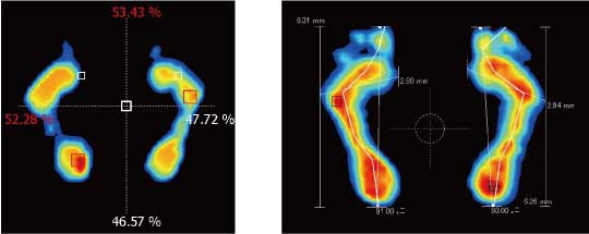 足圧分析の比較画像