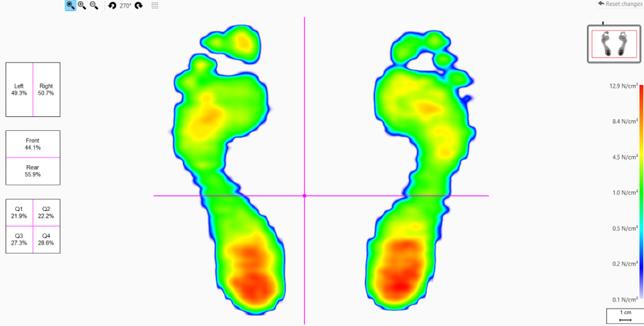 静止状態の計測・分析