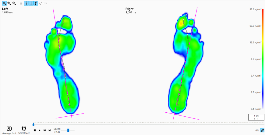 Dynamic:動作測定