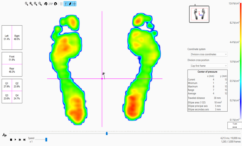 Balance:バランス測定