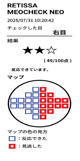 眼の健康支援装置 MEOCHECK NEO(メオチェックネオ)製品画像