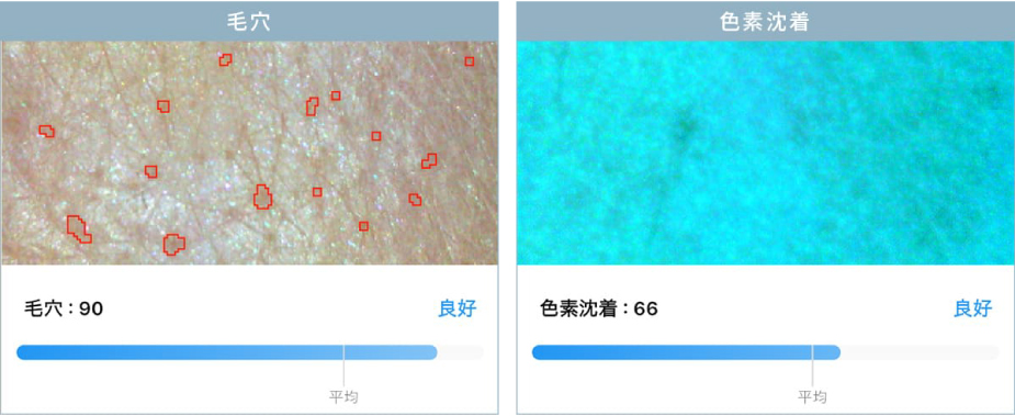 「毛穴」「色素沈着」