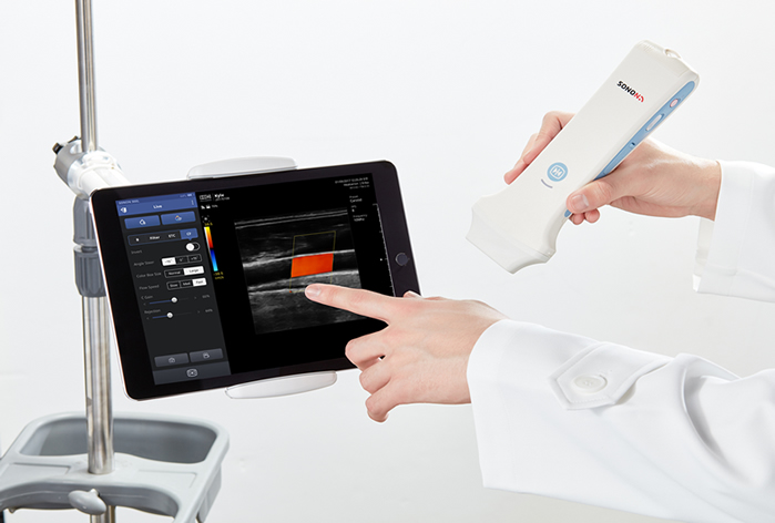 超音波画像診断装置SONON 300Lとタブレット 　製品画像