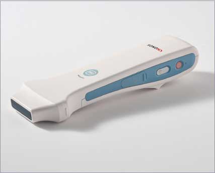 超音波画像診断装置SONON 300L