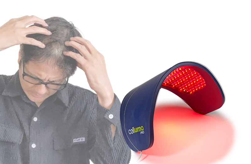 頭皮ケアメニューを強化したい