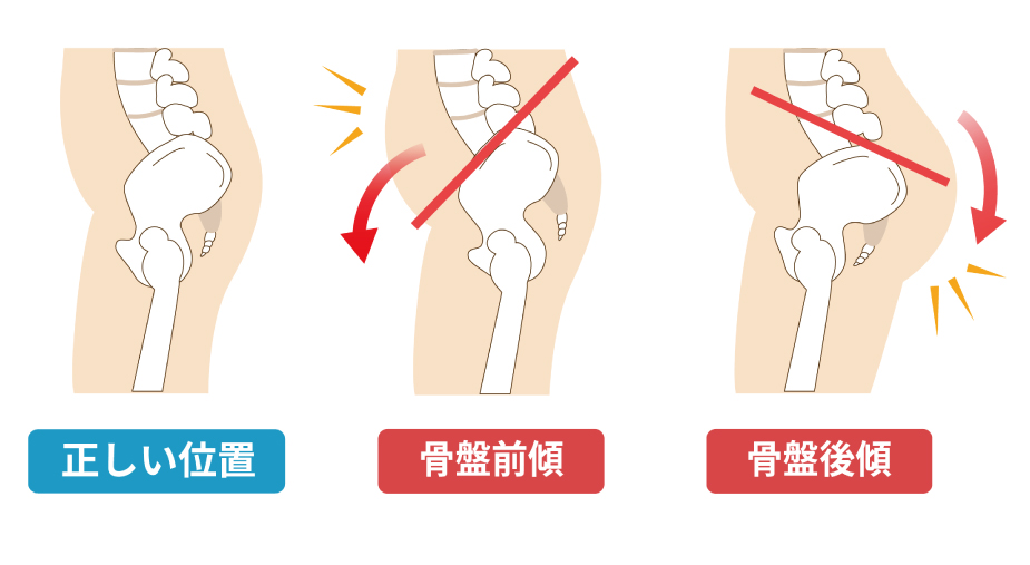 骨盤バランスを整えるケアに